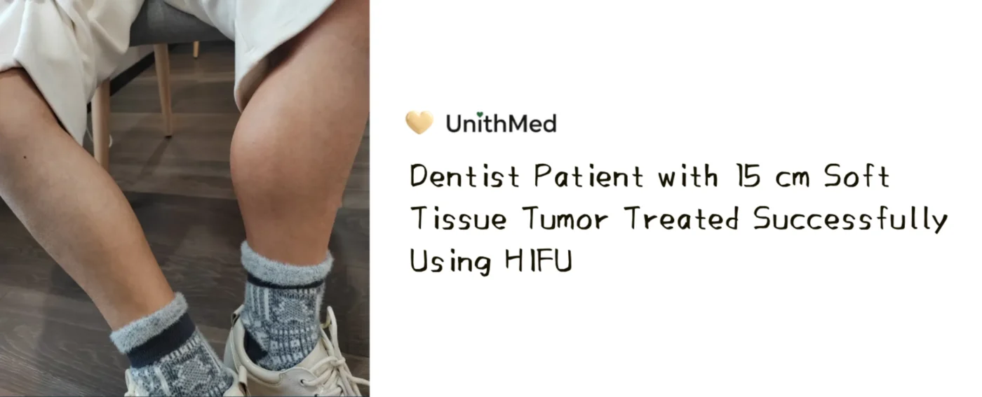 HIFU treatment for soft tissue tumor showing pre-treatment MRI of a large lesion in the left lower leg 2